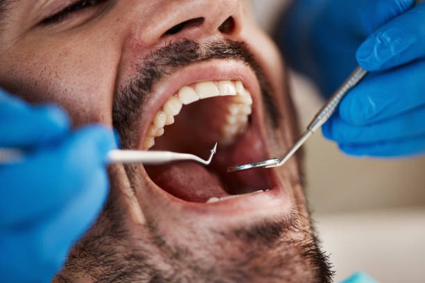 Tooth Infection Emergency Dentist in TN